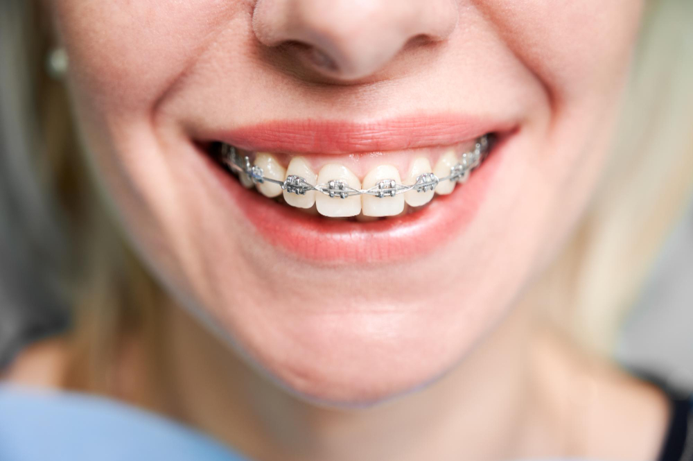 orthodontic services  Londonderry, NH